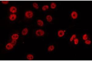 ABIN6274840 staining LOVO by IF/ICC. (APBB2 antibody  (Internal Region))
