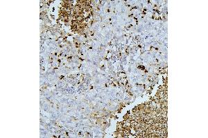IHC analysis of PEF1 using anti-PEF1 antibody (ABIN6719632). (PEF1 antibody  (AA 170-284))