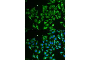 Immunofluorescence analysis of HeLa cells using CLEC3B antibody (ABIN5973819).