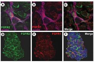 FGFR2/isolectinB4 (A) and FGFR1/isolectinB4 (B) staining of apparent mesenchymal cells and the subpopulation of endothelial cells.