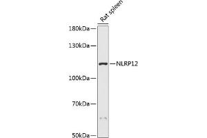 Western blot analysis of extracts of rat spleen, using NLRP12 antibody (ABIN7268937) at 1:3000 dilution. (NLRP12 antibody  (AA 862-1062))