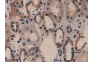 Detection of PLA2G4 in Human Kidney Tissue using Polyclonal Antibody to Cytosolic Phospholipase A2 (PLA2G4) (PLA2G4A antibody  (AA 563-749))