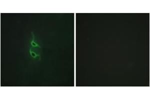 Immunofluorescence analysis of HepG2 cells, using MRC2 Antibody. (MRC2 antibody  (AA 121-170))