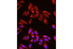 Immunofluorescence analysis of U2OS cells using TRIM4 Rabbit pAb (ABIN7270999) at dilution of 1:250 (40x lens). (TRIM4 antibody  (AA 1-280))