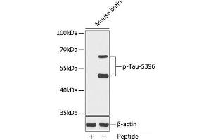Western blot analysis of extracts from Mouse brain tissue using Phospho-Tau(S396) Polyclonal Antibody. (tau antibody  (pSer396))