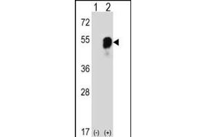 Western blot analysis of RS2 (arrow) using rabbit polyclonal RS2 Antibody (C-term) (ABIN6242575 and ABIN6577319). (PARS2 antibody  (C-Term))