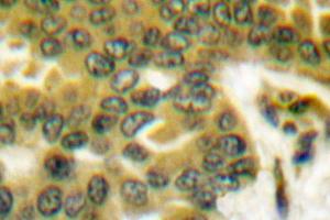 Image no. 1 for anti-Prostate Specific Antigen (PSA) antibody (ABIN271793) (Prostate Specific Antigen antibody)