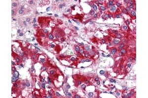 Immunohistochemistry (IHC) image for anti-Glutamate Decarboxylase 1 (Brain, 67kDa) (GAD1) (N-Term) antibody (ABIN785685) (GAD antibody  (N-Term))