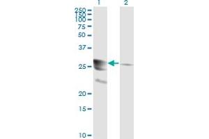 Western Blotting (WB) image for anti-GTP Cyclohydrolase 1 (GCH1) (AA 84-173) antibody (ABIN598708) (GCH1 antibody  (AA 84-173))