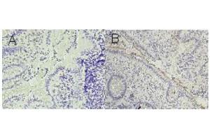 Immunohistochemical staining on cryosections of colon tissue using G5.