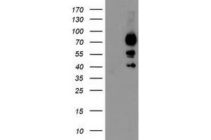 HEK293T cells were transfected with the pCMV6-ENTRY control (Left lane) or pCMV6-ENTRY KATNB1 (Right lane) cDNA for 48 hrs and lysed. (KATNB1 antibody)