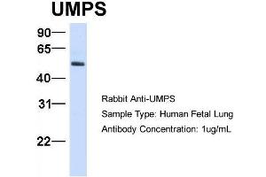 Host:  Rabbit  Target Name:  UMPS  Sample Type:  Human Fetal Lung  Antibody Dilution:  1. (UMPS antibody  (C-Term))
