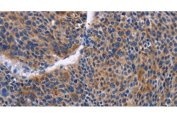 IGSF10 antibody