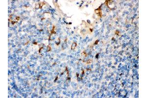 Filaggrin was detected in paraffin-embedded sections of human Tonsil tissues using rabbit anti- Filaggrin Antigen Affinity purified polyclonal antibody at 1 μg/mL.