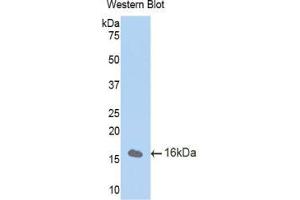 Western blot analysis of the recombinant protein. (CUBN antibody  (AA 3157-3274))