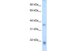 Western Blotting (WB) image for anti-Growth Hormone 2 (GH2) antibody (ABIN2462514) (Growth Hormone 2 antibody)