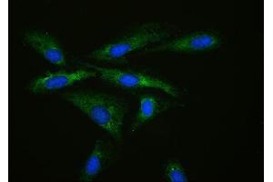 IF analysis of MPS1 using anti-MPS1 antibody (ABIN4886714). (RPS27 antibody  (AA 2-84))