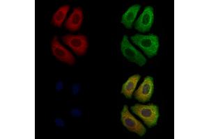 ABIN7094072 and ABIN7098116 staining Hela cells by IF/ICC.
