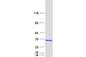 Validation with Western Blot (CMBL Protein (Myc-DYKDDDDK Tag))