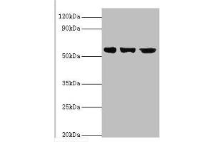 Western blot All lanes: Bardet-Biedl syndrome 4 protein antibody at 4 μg/mL Lane 1: Hela whole cell lysate Lane 2: U251 whole cell lysate Lane 2: Mouse heart tissue Secondary Goat polyclonal to rabbit IgG at 1/10000 dilution Predicted band size: 59, 60, 39 kDa Observed band size: 59 kDa