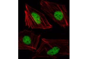 Fluorescent image of HUVEC cell stained with TBX15 Antibody (N-term) (ABIN1539402 and ABIN2849989). (T-Box 15 antibody  (N-Term))