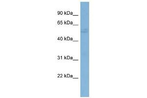 G3BP1 antibody used at 1 ug/ml to detect target protein. (G3BP1 antibody)