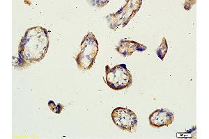 Formalin-fixed and paraffin embedded human placenta tissue labeled with Anti-Factor XIII Polyclonal Antibody, Unconjugated (ABIN731738) at 1:200 followed by conjugation to the secondary antibody, (SP-0023), and DAB staining (Factor XIII antibody  (AA 331-732))