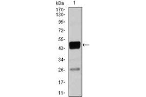 Western Blotting (WB) image for anti-CCAAT/enhancer Binding Protein (C/EBP), alpha (CEBPA) antibody (ABIN1106664) (CEBPA antibody)