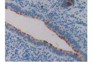 IHC-P analysis of Mouse Uterus Tissue, with DAB staining. (Clusterin antibody  (AA 227-447))