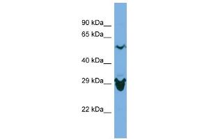 Host:  Rabbit  Target Name:  SEPHS2  Sample Type:  ACHN Whole Cell lysates  Antibody Dilution:  1. (SEPHS2 antibody  (C-Term))