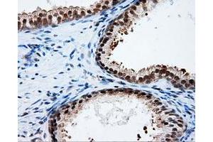 Immunohistochemical staining of paraffin-embedded Kidney tissue using anti-PTPRE mouse monoclonal antibody.