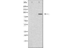 Western blot analysis of extracts from COLO cells, using TLK2 antibody.