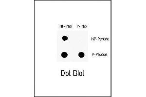 Dot Blot (DB) image for anti-C-Abl Oncogene 1, Non-Receptor tyrosine Kinase (ABL1) (pTyr251) antibody (ABIN6241067)