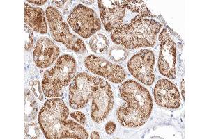 ABIN6266616 at 1/100 staining human kidney tissue sections by IHC-P. (Patched 1 antibody  (N-Term))