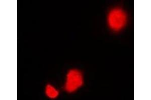 Immunofluorescent analysis of STIP1 staining in Hela cells. (STIP1 antibody)