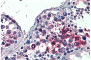 Human Testis (formalin-fixed, paraffin-embedded) stained with FHL1 antibody ABIN337221 at 2. (FHL1 antibody  (AA 261-272))