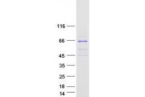 Western Blotting (WB) image for phosphoinositide Kinase, FYVE Finger Containing (PIKFYVE) (Transcript Variant 3) protein (Myc-DYKDDDDK Tag) (ABIN2729011)