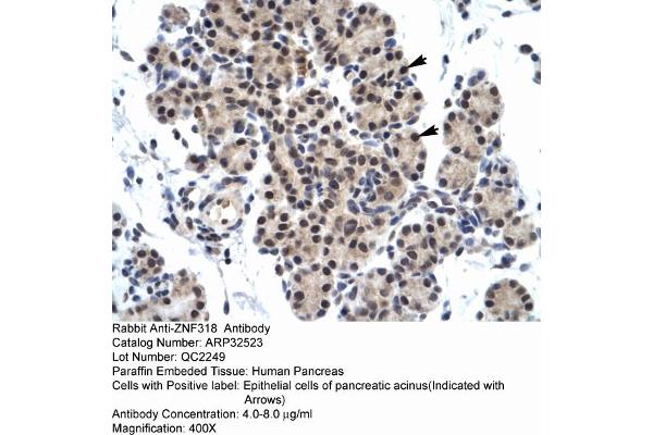 ZNF318 antibody  (N-Term)