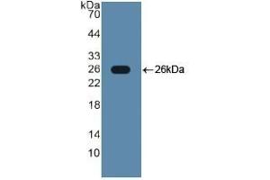 Detection of Recombinant TLR2, Human using Polyclonal Antibody to Toll Like Receptor 2 (TLR2) (TLR2 antibody  (AA 644-784))