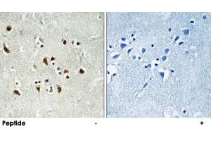 Immunohistochemistry analysis of paraffin-embedded human brain tissue using TUBGCP6 polyclonal antibody . (GCP6 antibody)