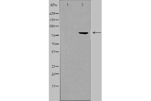Western blot analysis of extracts from HuvEc cells, using ALS2CR8 antibody. (CDKN2AIP antibody  (Internal Region))