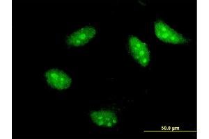 Immunofluorescence of monoclonal antibody to TWIST1 on HeLa cell. (TWIST1 antibody  (AA 100-202))