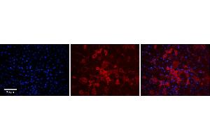 Immunohistochemistry (IHC) image for anti-Solute Carrier Organic Anion Transporter Family, Member 1A2 (SLCO1A2) (Middle Region) antibody (ABIN2781619)