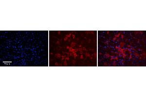 Rabbit Anti-SLCO1A2 Antibody  Catalog Number: ARP43899_P050 Formalin Fixed Paraffin Embedded Tissue: Human Adult Liver  Observed Staining: Membrane, Cytoplasm in hepatocytes, very strong, moderate tissue distribution Primary Antibody Concentration: 1:100 Secondary Antibody: Donkey anti-Rabbit-Cy3 Secondary Antibody Concentration: 1:200 Magnification: 20X Exposure Time: 0. (SLCO1A2 antibody  (Middle Region))