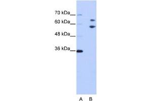 WB Suggested Anti-TROVE2 Antibody Titration:  0. (TROVE2 antibody  (N-Term))