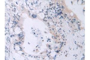 Immunohistochemistry (IHC) image for anti-Macrophage erythroblast Attacher (MAEA) (AA 136-379) antibody (ABIN7440146)
