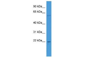 WB Suggested Anti-FATE1 Antibody Titration: 0. (FATE1 antibody  (N-Term))