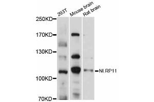 Western blot analysis of extracts of various cell lines, using NLRP11 antibody (ABIN6292815) at 1:1000 dilution. (NLRP11 antibody)
