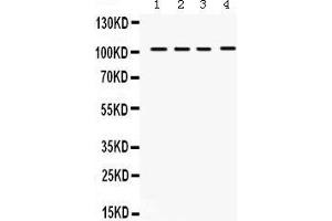 Western Blotting (WB) image for anti-Histone Deacetylase 7 (HDAC7) (AA 68-103), (N-Term) antibody (ABIN3042441) (HDAC7 antibody  (N-Term))
