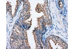 Immunohistochemical staining of paraffin-embedded Kidney tissue using anti-BTK mouse monoclonal antibody. (BTK antibody)
